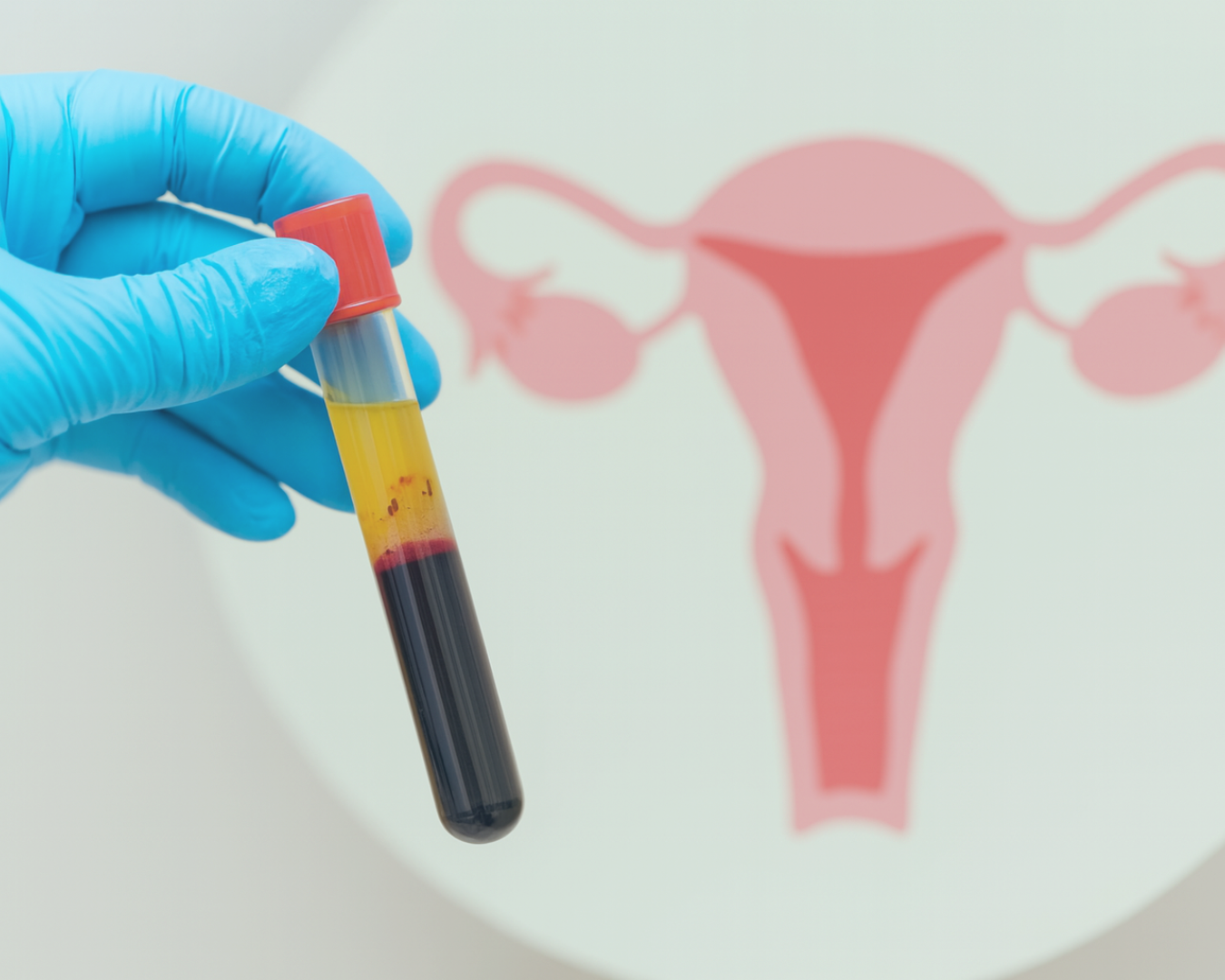 IVF Baden Baden